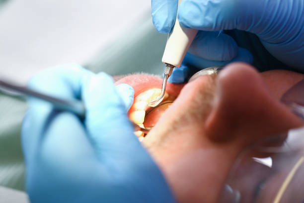 Best Tooth Infection Emergency Dentist  in East Quogue, NY